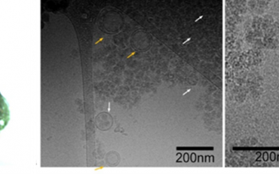 Cryo-TEM of extracellular vesicles derived from flatworm